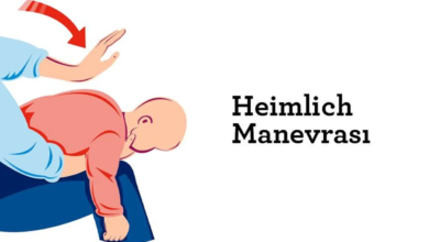 Heimlich Manevrası Nedir ve Nasıl Yapılır1