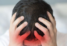 Migren Şiddetli Baş Ağrısının Altında Yatan Nedenler1