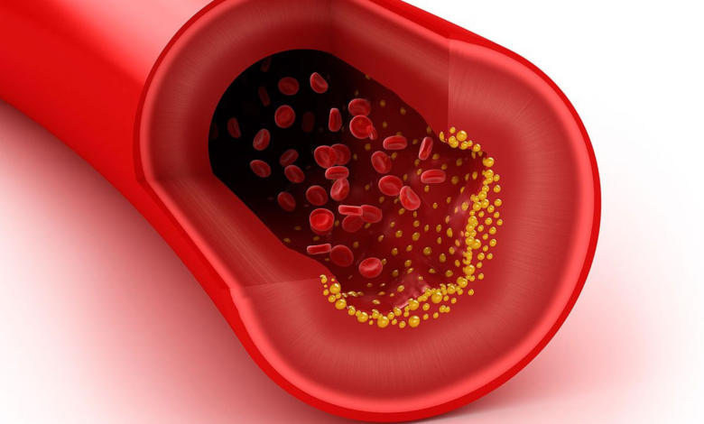 Kolesterolün Sağlık Üzerindeki Etkileri Nelerdir1