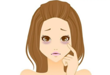 Göz Altı Morluklarına Etkili ve Doğal Çözüm Yöntemleri